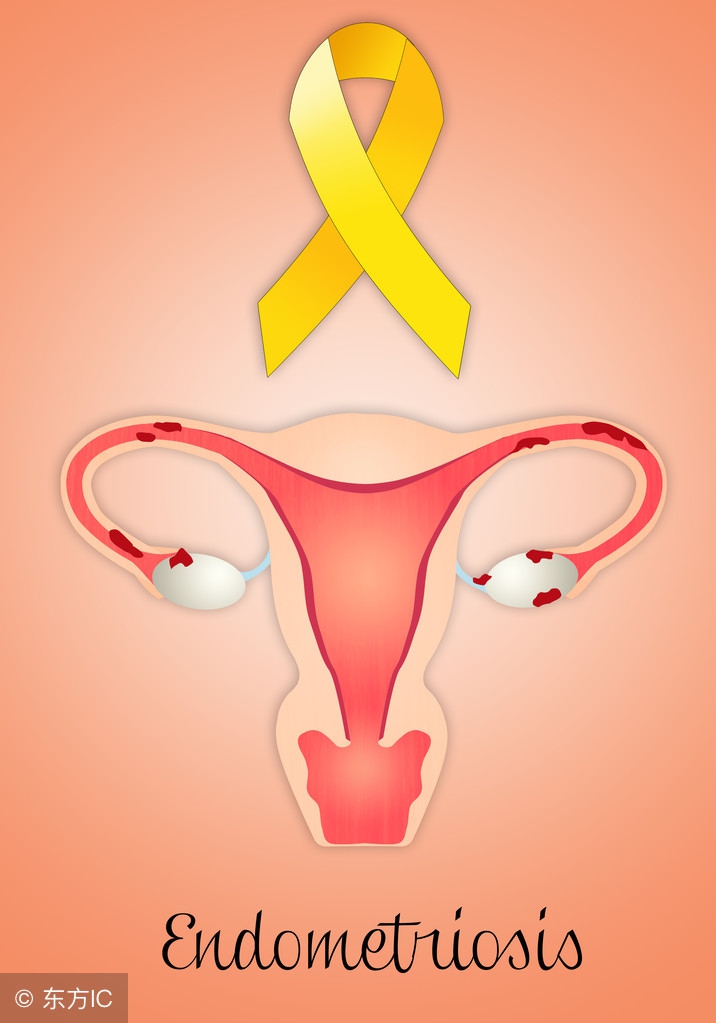 宫颈肥大做彩超能发现吗,宫颈肥大宫颈纳囊能治好吗