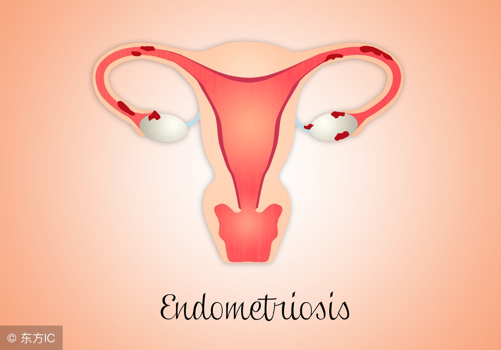 女性宫颈肥大用什么药,宫颈肥大下垂什么症状