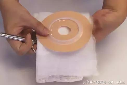 造口护理小窍门视频,更换造口护理技术操作流程