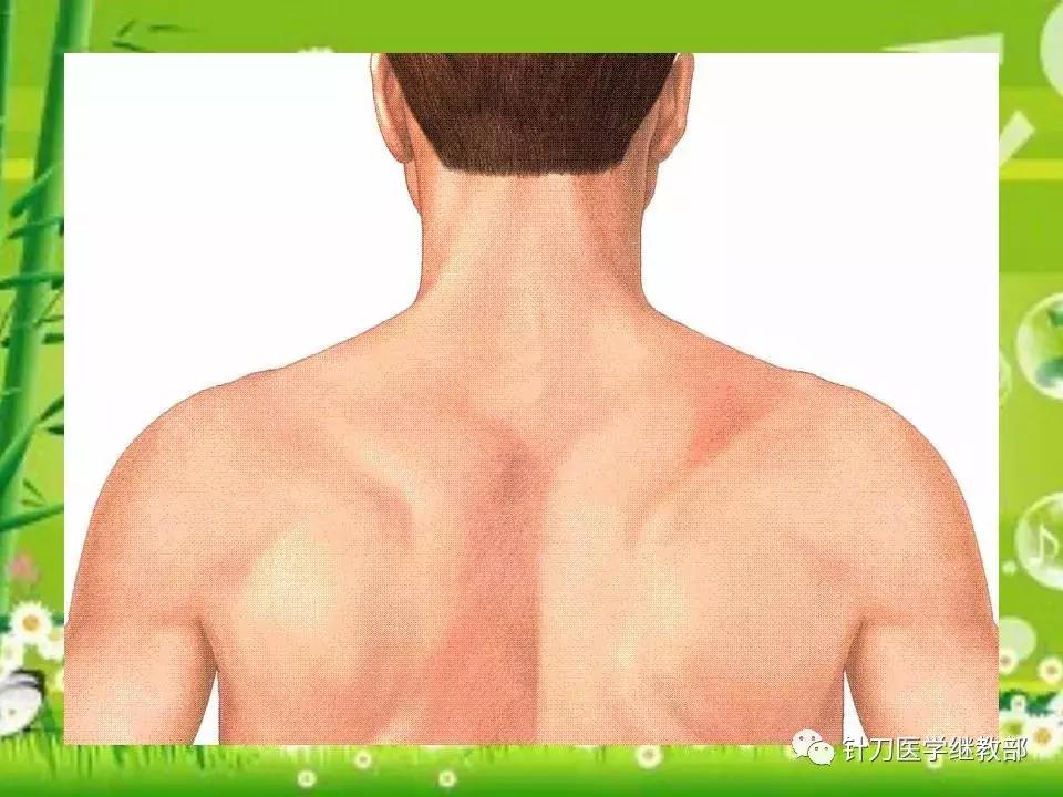 颈椎肌肉损伤用小针刀治疗,针刀治疗颈椎导致神经损伤