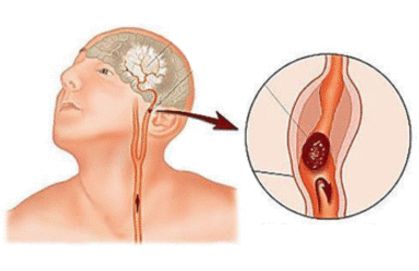 我们该怎么预防肥胖,世界防治肥胖日远离肥胖享瘦健康