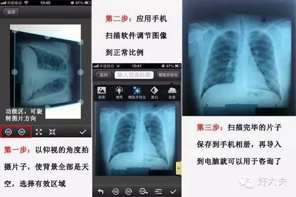 家里怎么拍片子给医生,如何把拍的ct片发给医生