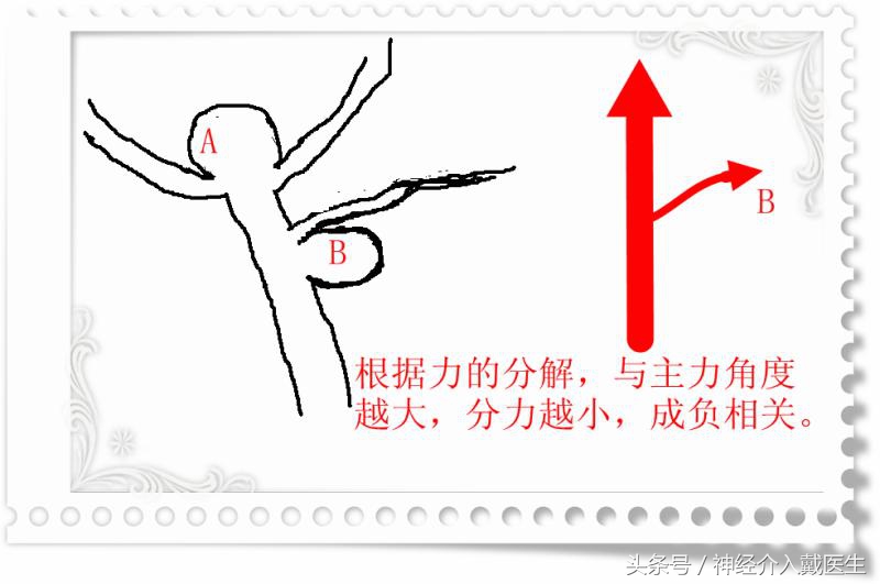 动脉瘤诊断与鉴别诊断,脑动脉瘤出血100ml手术预后