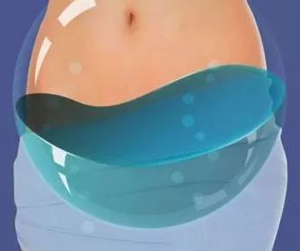 妇科b超检查出盆腔积液,妇科做b超说有积液怎么回事