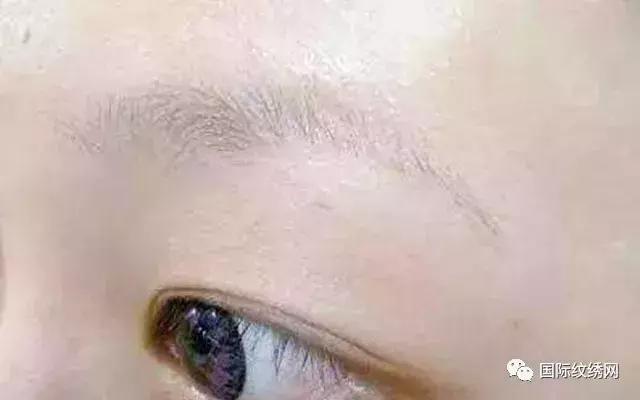 半永久眉失败了怎么办,半永久眉毛眉形不好怎么办