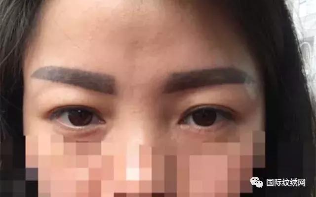 半永久眉失败了怎么办,半永久眉毛眉形不好怎么办