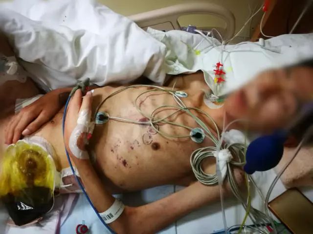 27岁清华医生脑死亡捐器官救5人,27岁清华医生脑死亡捐献器官救5人