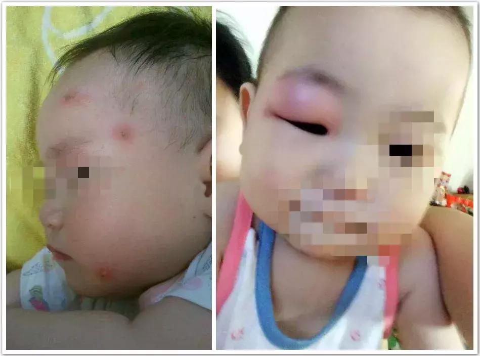 蚊子用什么农药治,蚊子最怕的农药