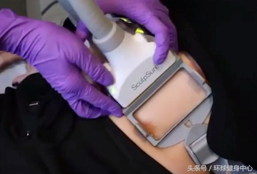 躺着都能瘦的方法除了抽脂,有一种减肥塑形的黑科技