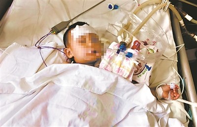 误食蚊香液肺部及胃部出血,误食蚊香液洗胃