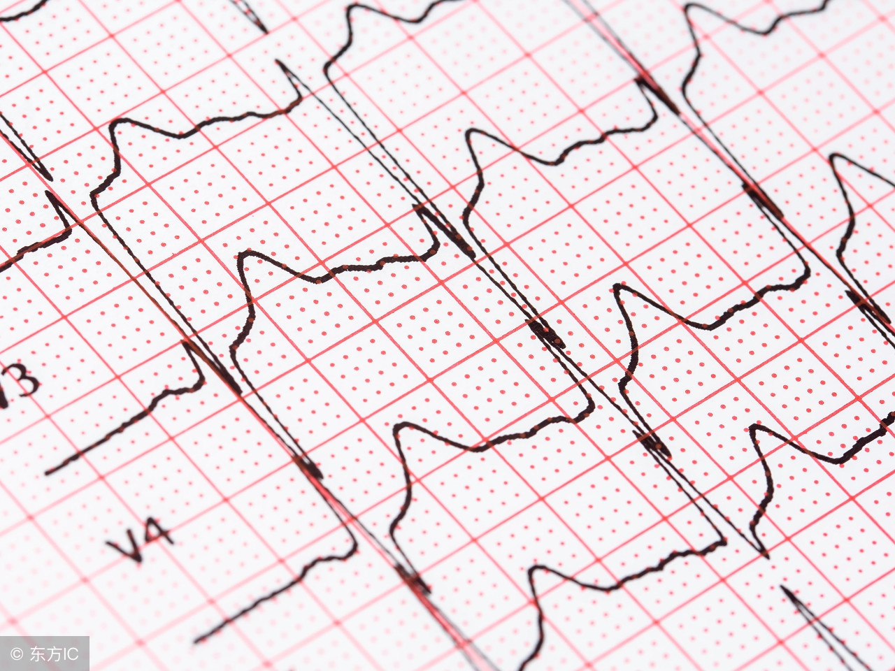 风心病出现房颤怎么办,房颤该怎么办
