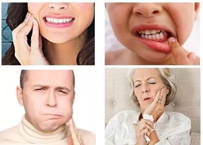 口腔溃疡药5秒止痛,口腔溃疡药1秒止痛