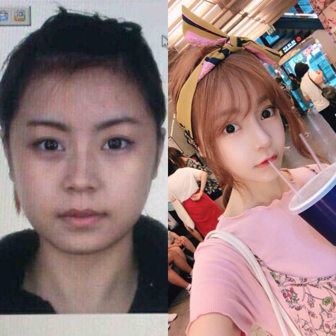 广州整形医院哪家是正规医院,国内知名整形医院