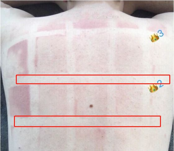 小哥暴晒3小时测防晒霜,小哥测试15款防晒霜