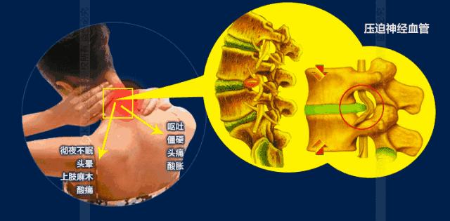 日本治疗创伤性关节炎,治疗关节炎的日本进口药