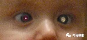 反转？！父母拿3岁患癌女儿捐款治儿子兔唇？嫣然基金：弟弟是我们给钱治的