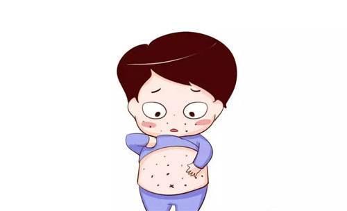麻疹预防措施,麻疹的中医药预防与治疗方法