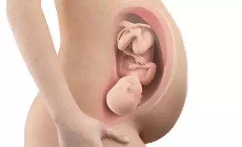 产检心室有强光斑,心室强光斑是怎么回事