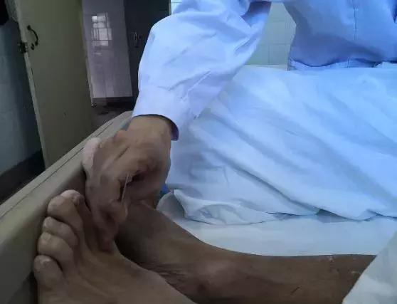 治病手工,纯手工修复真是高手在民间