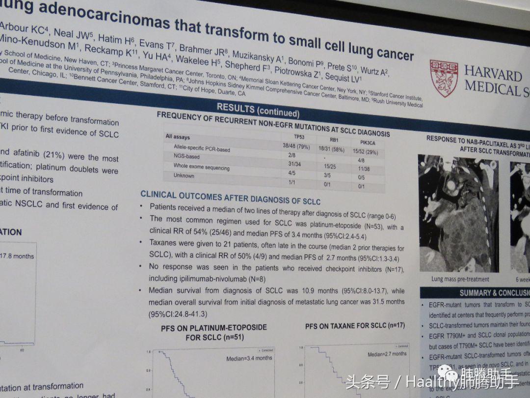 2018ASCO｜“转化治疗”只能坐以待毙？来看看它的疗效如何？