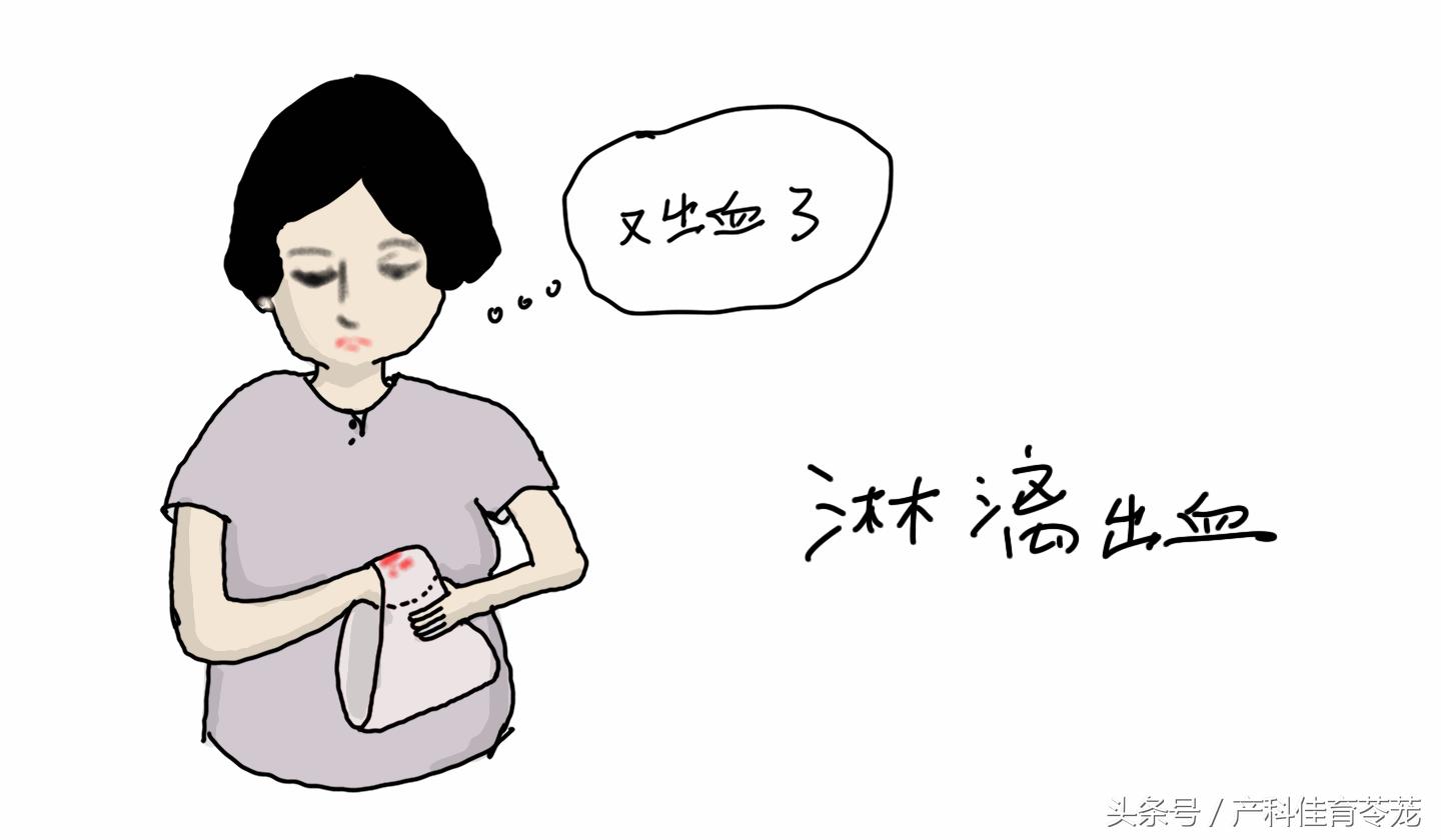 放曼月乐环可以起到避孕作用吗,曼月乐环单纯避孕的话需要换吗