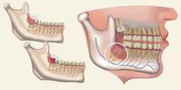 战痘多年才知道的真相,战痘多年不见效果