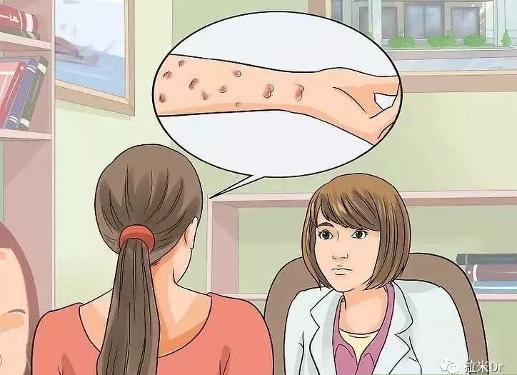 Hiv药物中哪个成分引起皮疹,hiv药物副作用会引起脸肿大吗