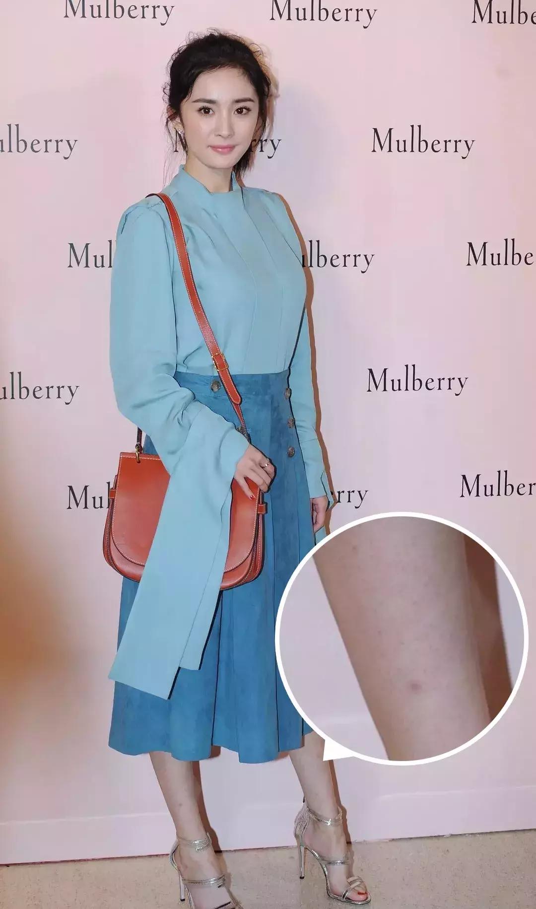 夏天最尴尬的3件事,在夏天碰到过哪些尴尬事