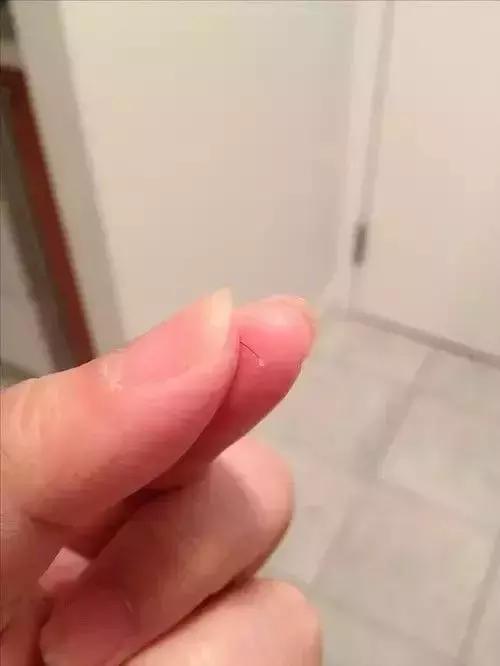 头发根部变白然后脱落,头发慢慢变白怎么办