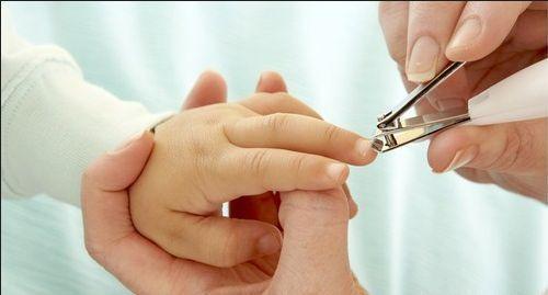 孩子指甲掉了还能去幼儿园吗,孩子在幼儿园指甲被门夹掉了