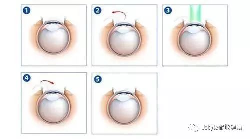 爱眼日｜最全的眼睛护理，哪些护眼方法最靠谱