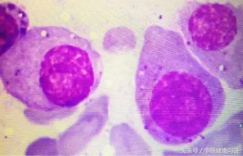 肺部反复感染吃哪种药提高抵抗力,肺部感染反复发烧抗生素治疗无效