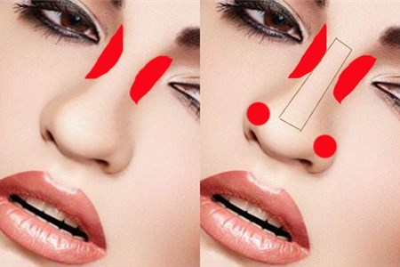 平鼻塌鼻梁怎么化妆才好看,塌鼻子鼻翼大怎么化妆