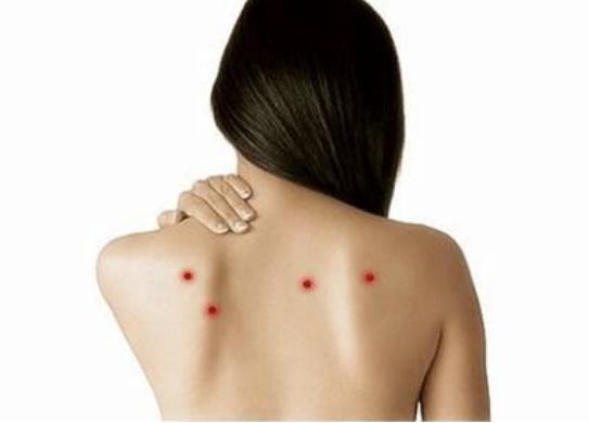 后背总长痘的解决方法,后背脖子长痘是什么原因