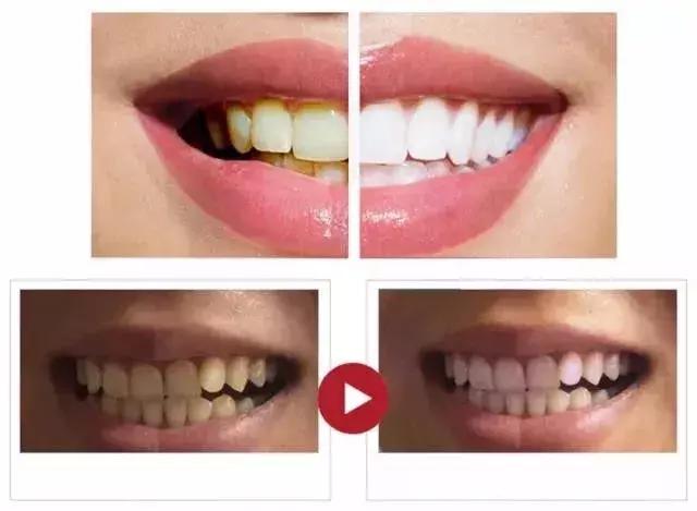 二十岁女生口臭怎么治,二十岁女孩口臭吃什么药