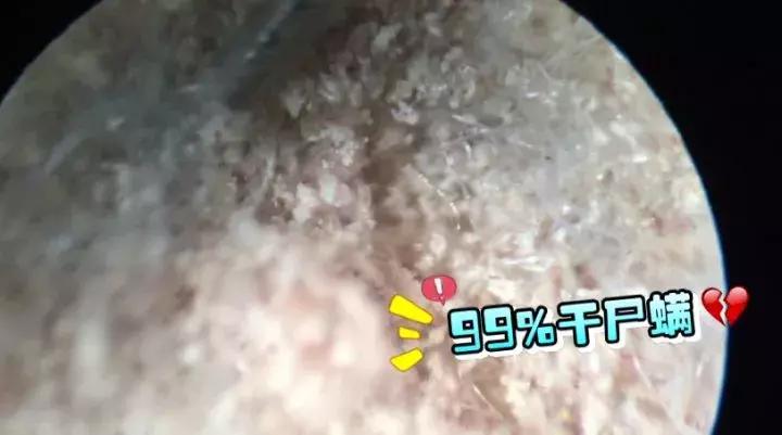 孩子也没感冒突然就开始咳嗽,孩子打喷嚏流鼻涕但没有感冒