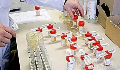 尿常规检查的各项指标及含义图解,尿常规怎么看图解