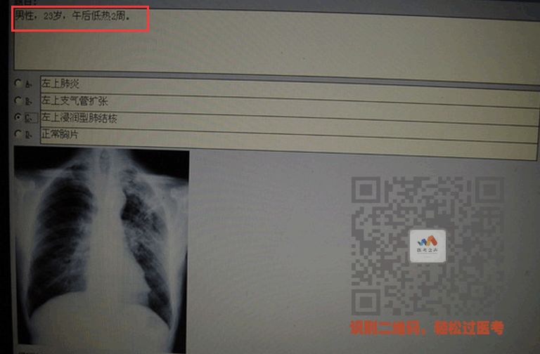 执医技能：X线阅片，全是套路，超简单