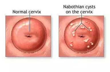 您还在为这3种宫颈的表现而困扰吗?那就太OUT了!