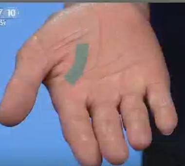 手健康有多重要,手型看健康