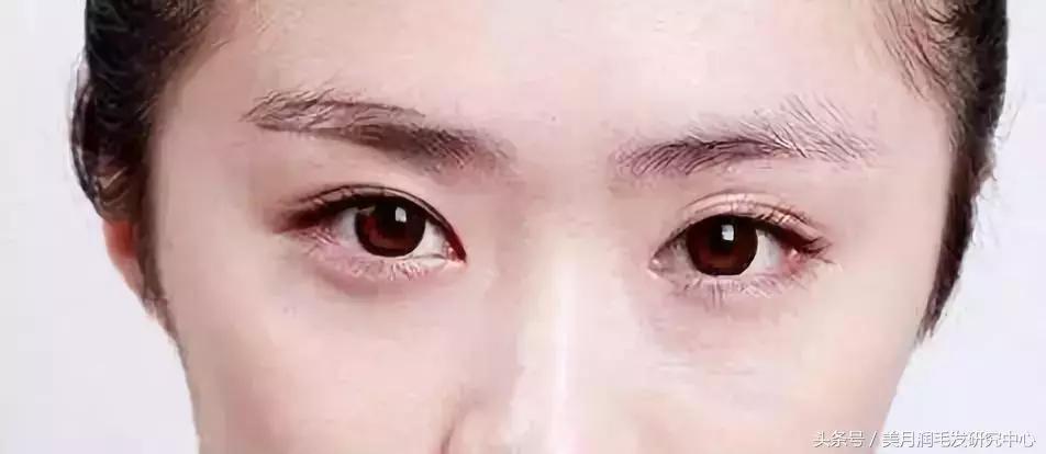 没有眉毛是什么样的,没有眉毛是有多么不方便