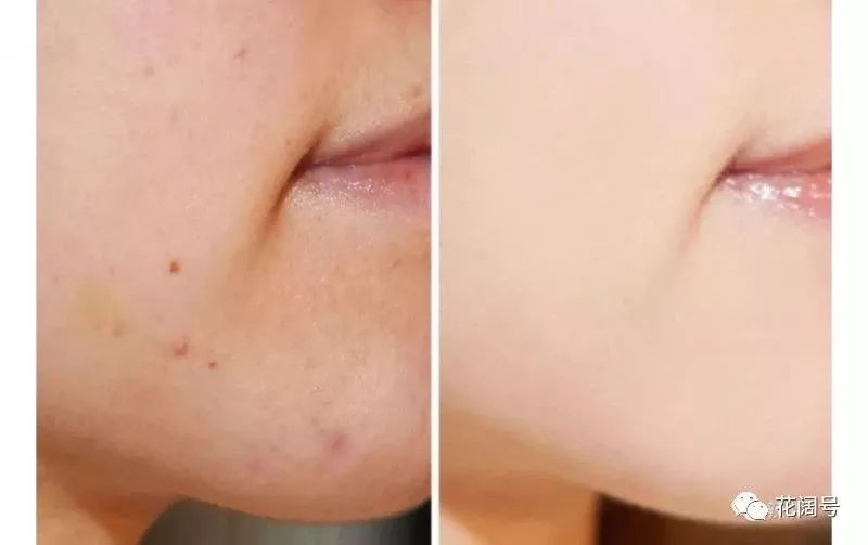 俄罗斯好物推荐视频,俄罗斯好物推荐官方