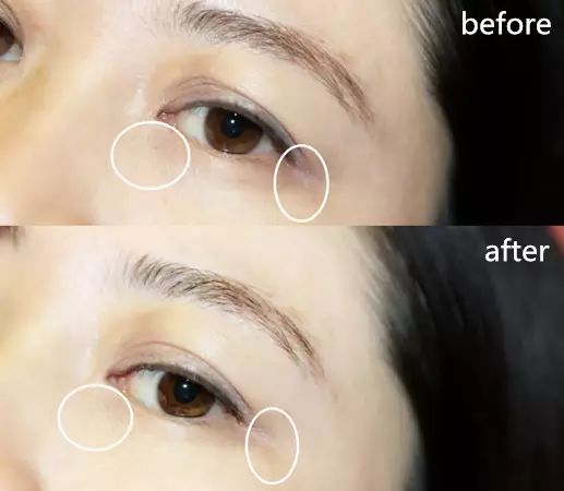 30岁眼角笑起来有皱纹,眼角笑起来有皱纹是老了吗