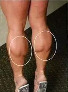 腿型怎样判断是粗腿还是细腿,腿型好看的肌肉腿