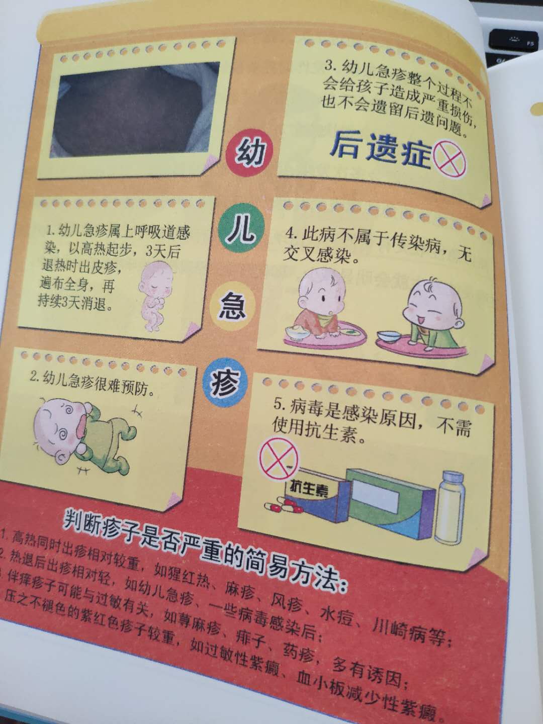 幼儿急疹高热怎么处理,小孩急疹的症状要怎么处理