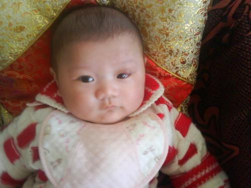 小孩子麦粒肿一般多少天自愈,孩子麦粒肿一般多久自愈