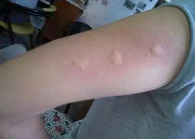 勒夫黄磊李小璐都在用的驱蚊装备,口碑不输sixgod!