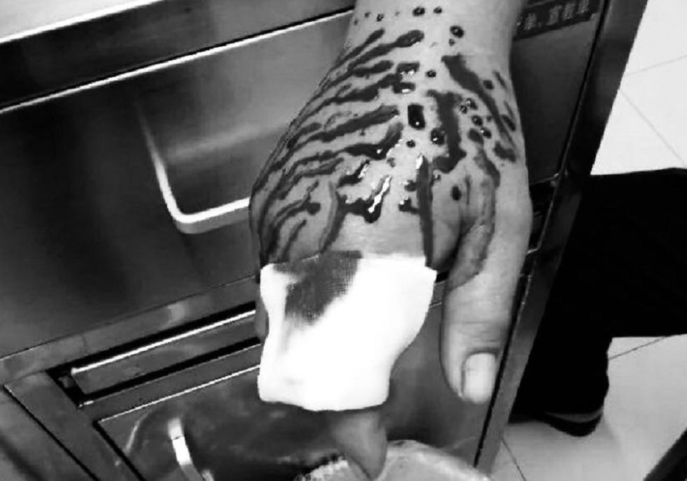 自家别墅花园有蛇什么原因,深圳一别墅区惊现蛇出没