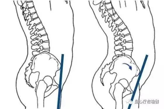 脚趾头无法弯曲怎么回事,脚趾不受控制是什么原因