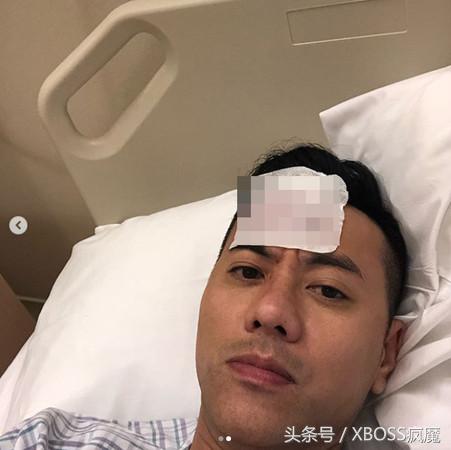 看世界杯一半GG！梁汉文头猛撞桌角「伤口见骨」缝37针